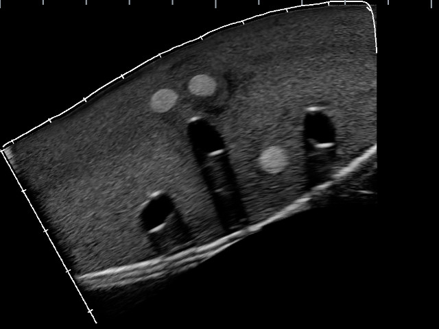 Gphantom Anestesia - Imagem 3