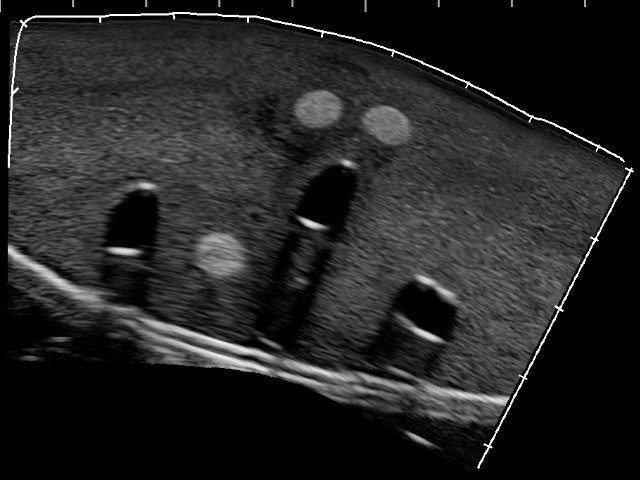 Gphantom Anestesia - Imagem 5
