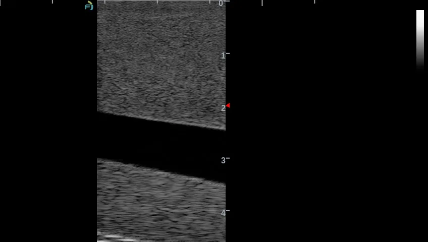 Gphantom 5 vias - Imagem 3