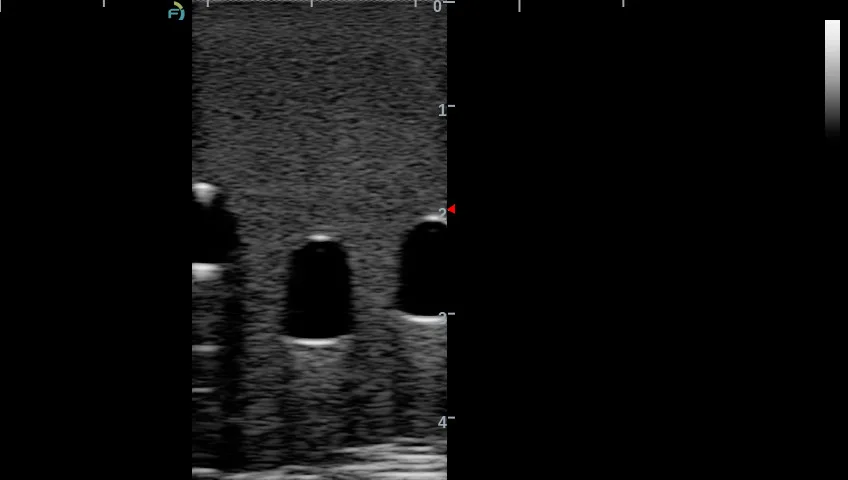 Gphantom 5 vias - Imagem 7